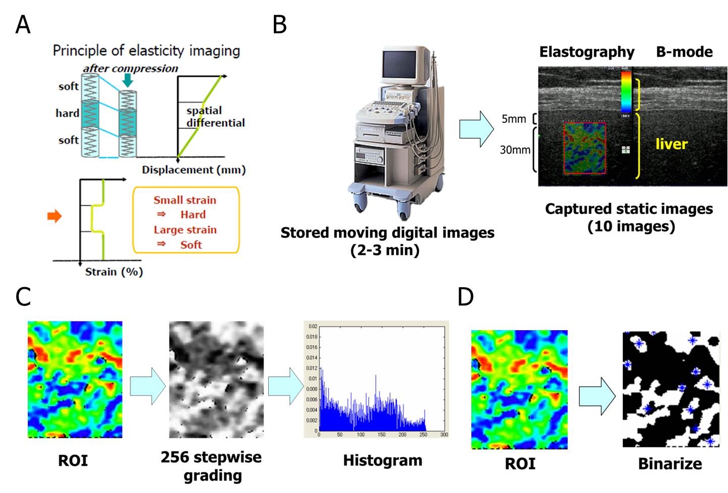 Эластография это. Принципиальная схема компрессионной эластографии. Real time Elastography. Transient Elastography.