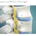 Διαδικασία μεθόδου Discogel