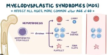 Μυελοδυσπλαστικα σύνδρομα (MDS)